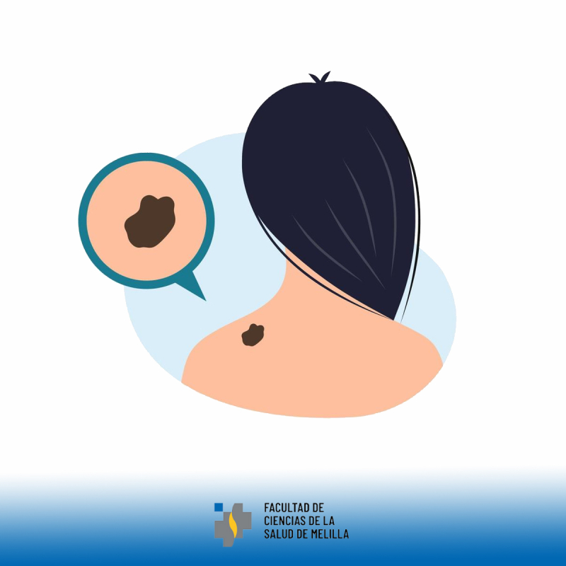 Día Mundial contra el Melanoma Día Mundial contra el Melanoma