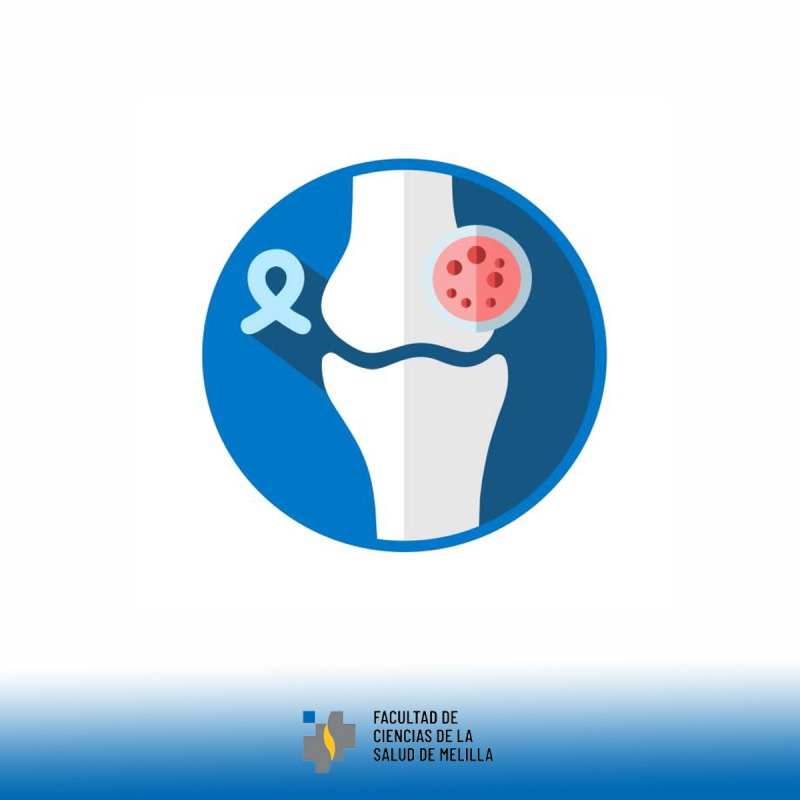 Día Internacional Del Sarcoma Día Internacional Del Sarcoma