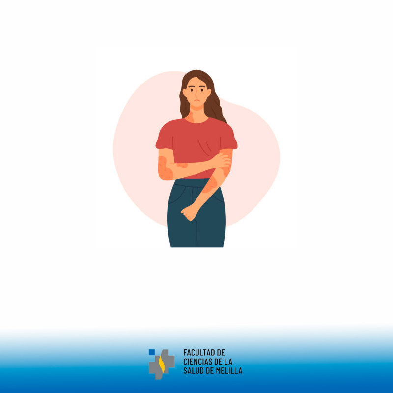 Día Mundial contra la Psoriasis Día Mundial contra la Psoriasis
