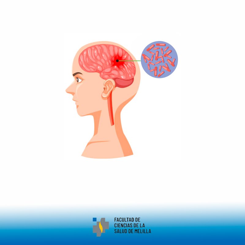 Día Mundial de la Meningitis Día Mundial de la Meningitis