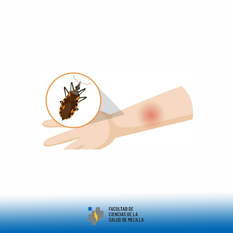 馃實馃挌 Hoy conmemoramos el D铆a Mundial de la Enfermedad de Chagas 馃挌馃實 馃實馃挌 Hoy conmemoramos el D铆a Mundial de la Enfermedad de Chagas 馃挌馃實