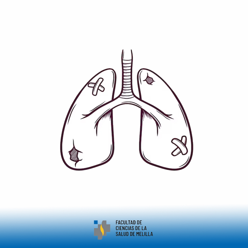 馃珌馃挋 Detener la tuberculosis es tarea de todos: D铆a Mundial de la Tuberculosis 馃挋馃珌 馃珌馃挋 Detener la tuberculosis es tarea de todos: D铆a Mundial de la Tuberculosis 馃挋馃珌