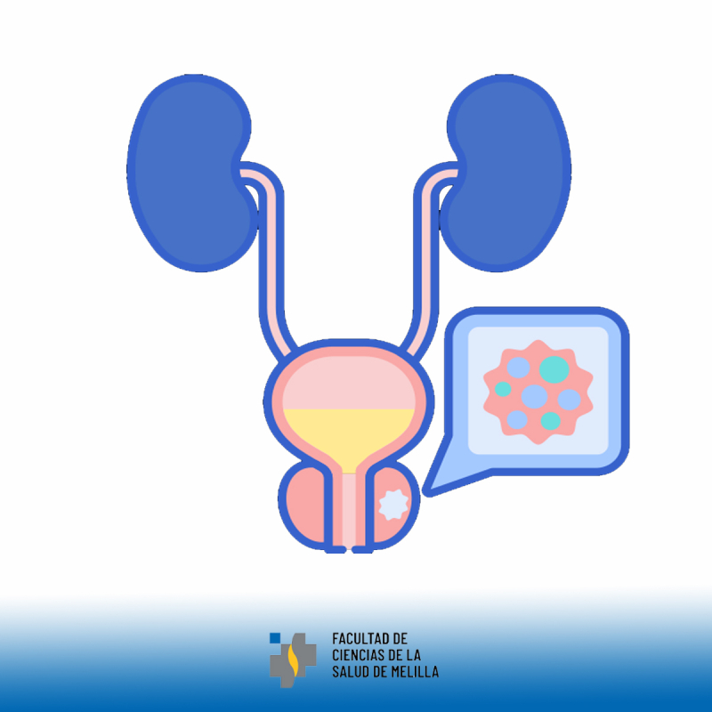 📅 Día Mundial del Cáncer de Próstata – 11 de junio 📅 Día Mundial del Cáncer de Próstata – 11 de junio